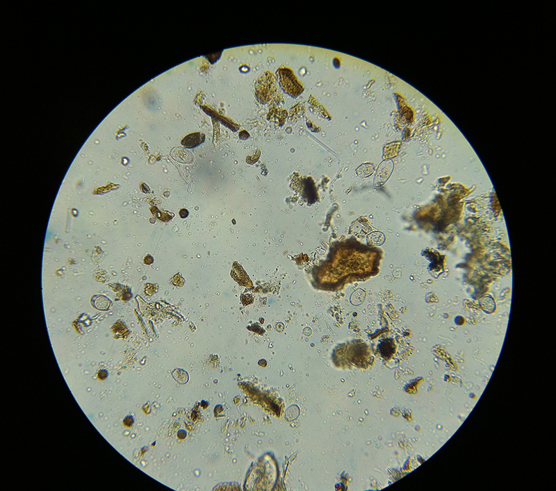 Amoeba Microscopy