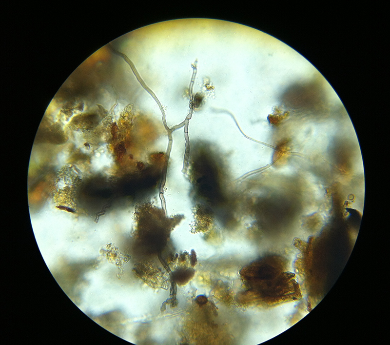 Fungal Hypae microscopy