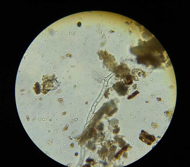 Fungi microscopy