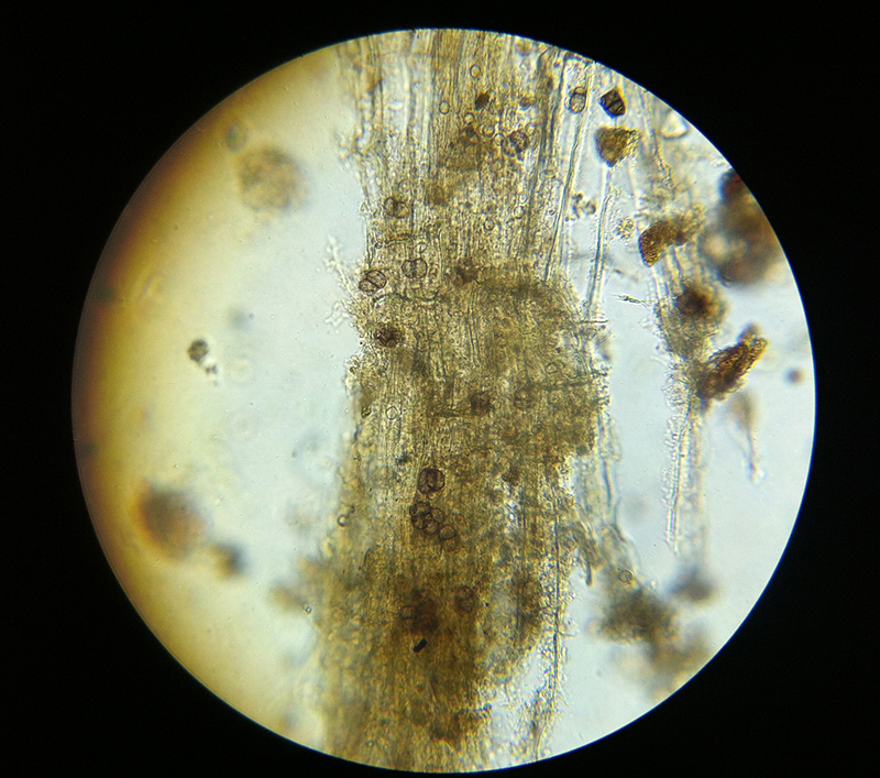 Fungal Spores in OM microscopy