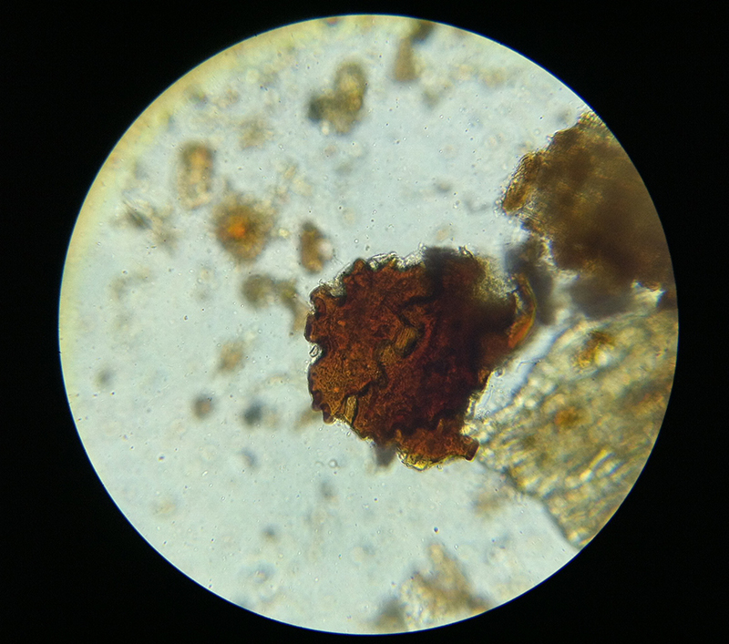 Humus Microscopy