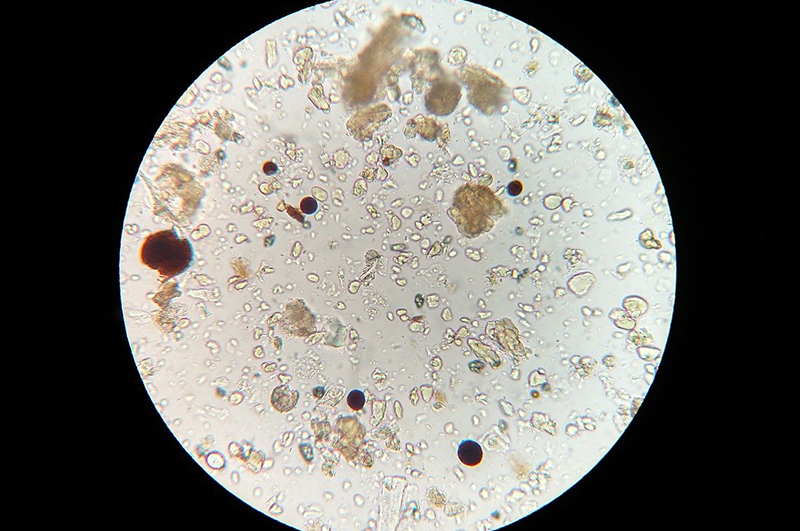soil microbes in petri dish